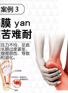 日本扁平足矫正鞋垫纠正OX型腿