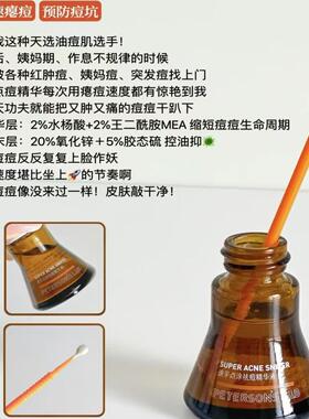 点痘精华液快速祛痘精华液
