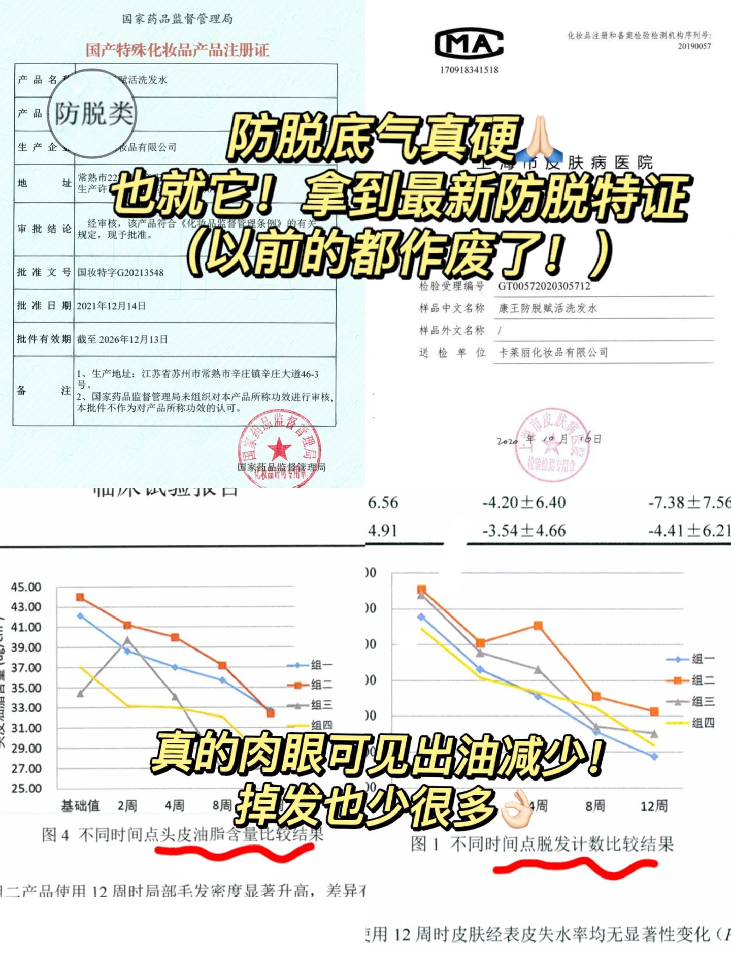 实力硬货！拜耳康王防脱精华洗发水腺苷头皮育发生发液固发密发 - 图1