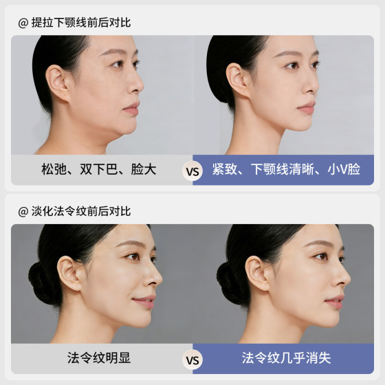 New Facial Yoga Dumbbells for Women, Face Slimming and Massage Magic Tool, Lifting and Firming the Jawline, Apple Muscles, and Diminishing Nasal Nasal Lines