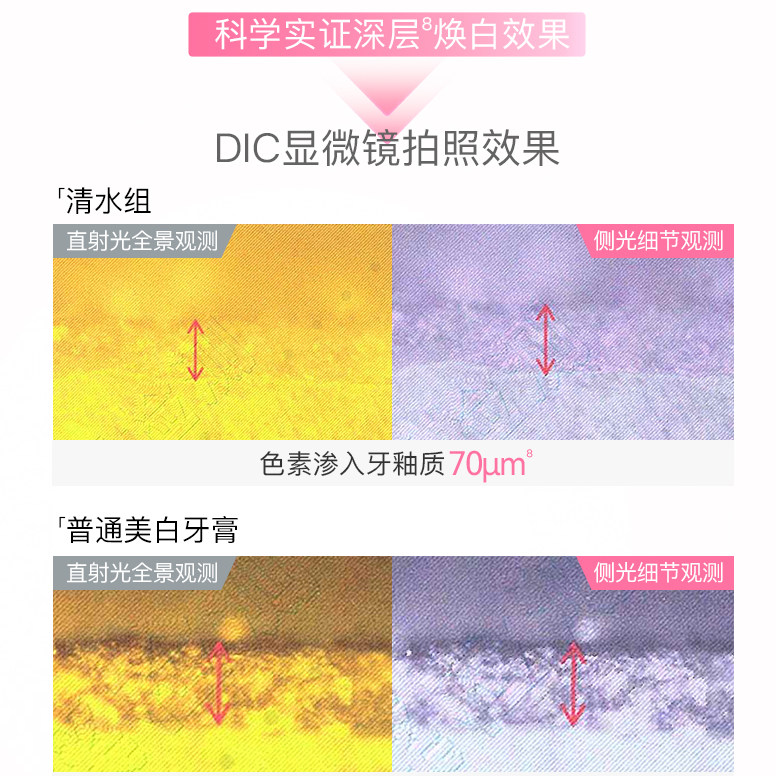 舒客酵素牙膏肖战同款美白去黄