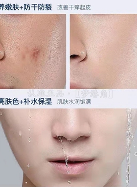 男士面霜补水保湿专用美白控油清爽防干裂乳液擦脸油护肤品润肤乳