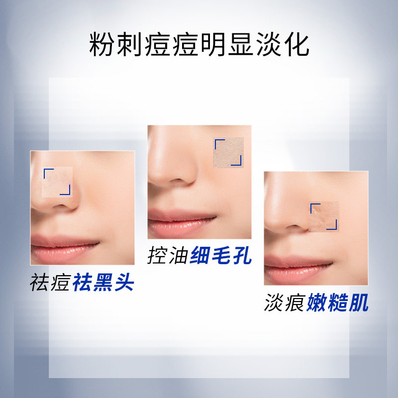 博乐达水杨酸去黑头闭口粉刺控油 broda博乐达涂抹面膜