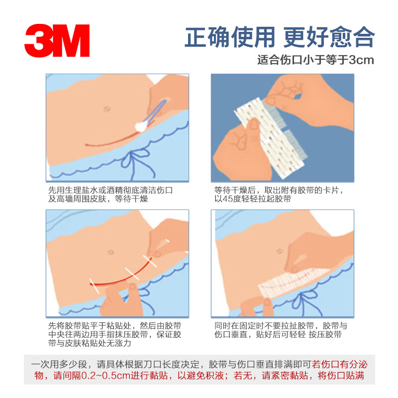 3M免缝胶带减张贴皮肤伤口拉合胶带R1542剖腹产疤痕修复贴R1547 - 图2