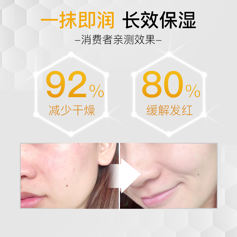 beesline滋润护手霜补水保湿不油腻女夏敏感肌可用面霜男士 - 图1