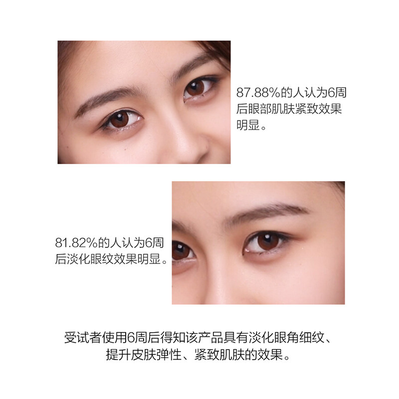 【博博推荐】b218马应龙去黑眼圈眼霜 马应龙八宝眼霜