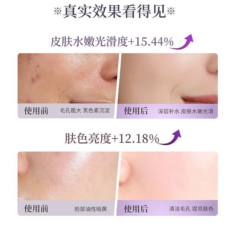 蒸脸仪冷热双喷纳米补水喷雾器蒸汽机面脸部家用美容仪专用蒸脸器,淘宝优惠券,粉丝福利购,淘宝优惠卷