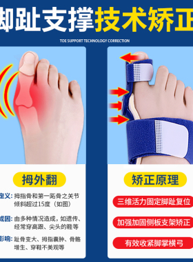 德国拇指外翻矫正器分大母脚趾头足改善纠正大脚骨可以穿鞋男女士