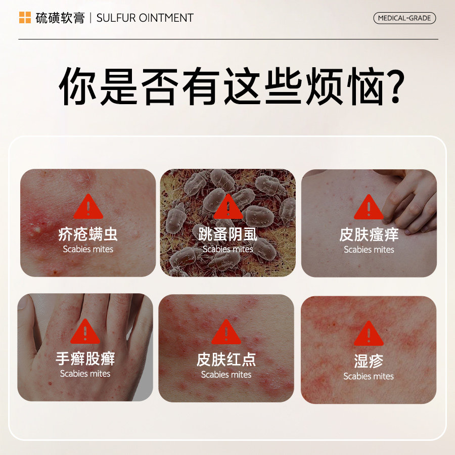 硫磺软膏正品官方旗舰店医用硫磺膏去阴虱抑菌螨虫疥疮专用止痒膏,淘宝优惠券,粉丝福利购,淘宝优惠卷