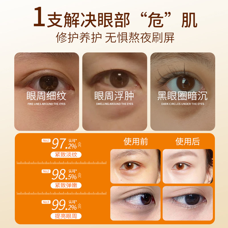 vc叶黄素眼部精华油紧致抗皱眼油衰老眼霜淡化细纹黑眼圈消眼袋,淘宝优惠券,粉丝福利购,淘宝优惠卷