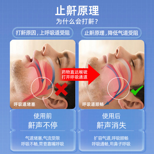 仁和液体止鼾器打呼噜止鼾神器喷雾医用男士防呼噜消治打鼾女打呼 - 图1