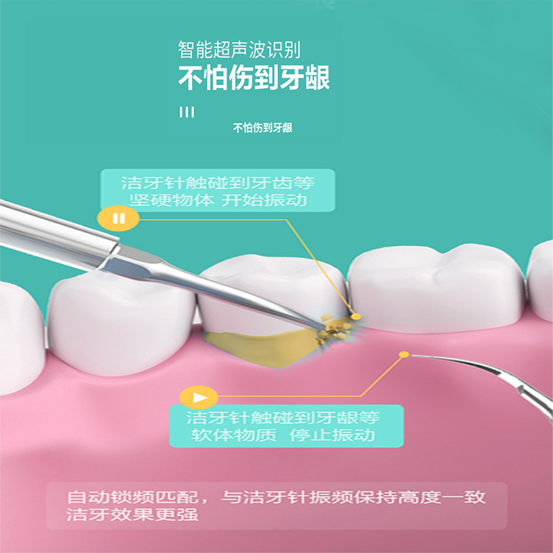 超声波洁牙器小米优品便携式口腔清洁牙齿家用牙黄冲牙器去牙结石