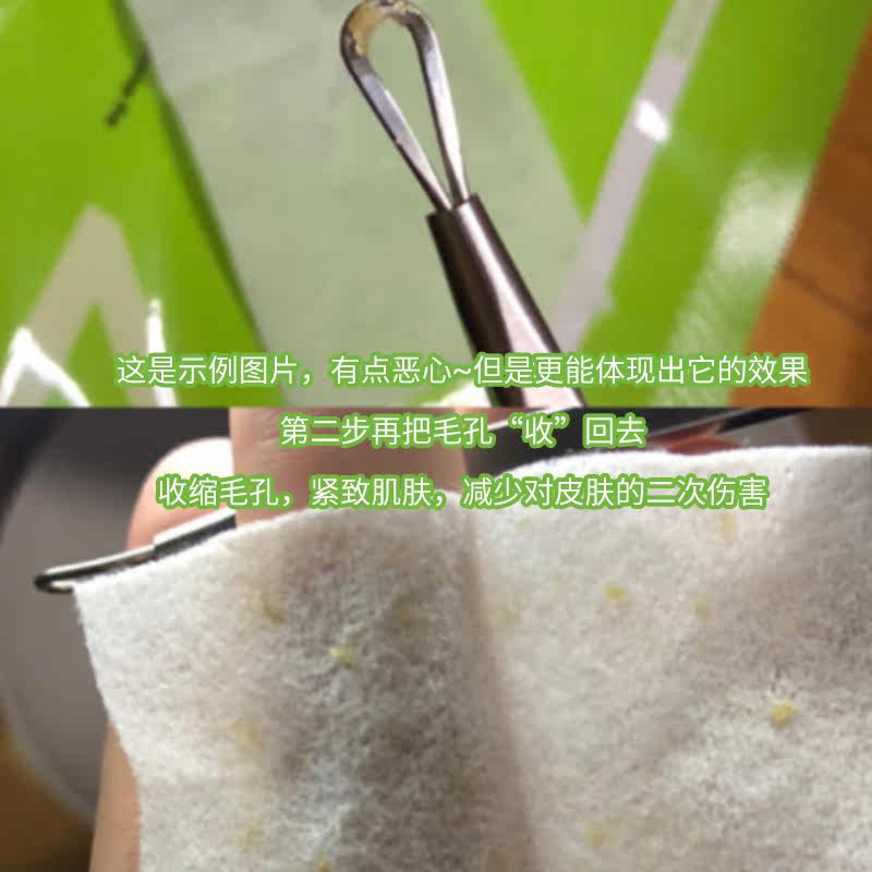 韩国cnp希恩派去黑头黑头导出液 小熊牛鼻帖