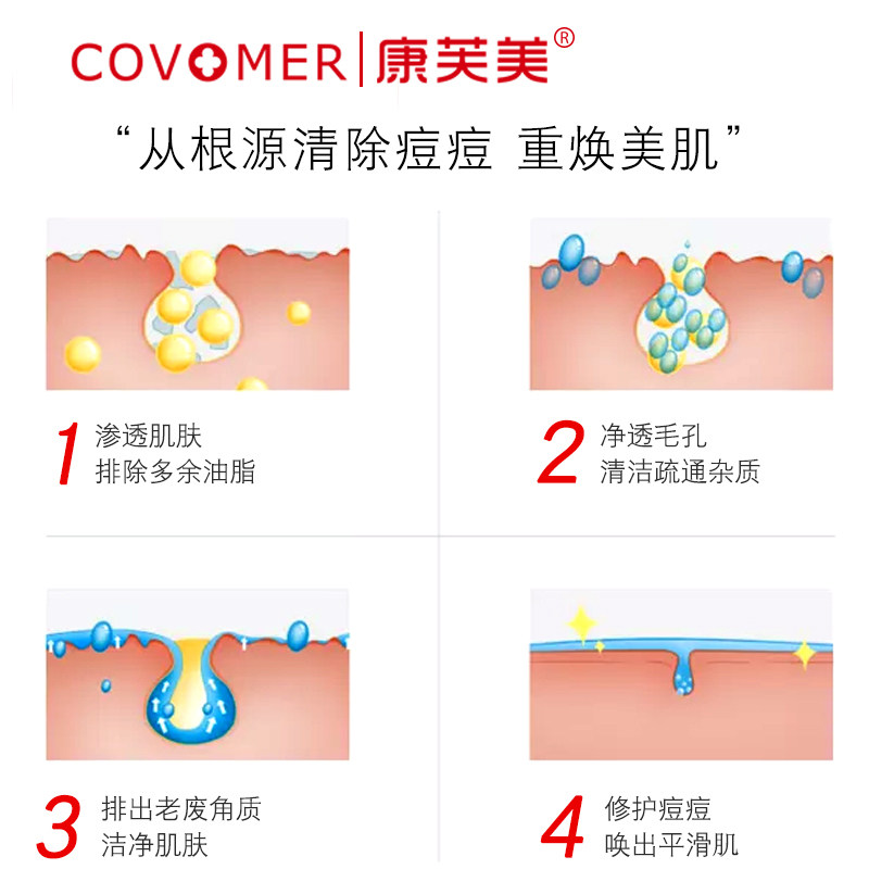 康芙美清痘净颜喷雾补水细致爽肤水 康芙美化妆水/爽肤水