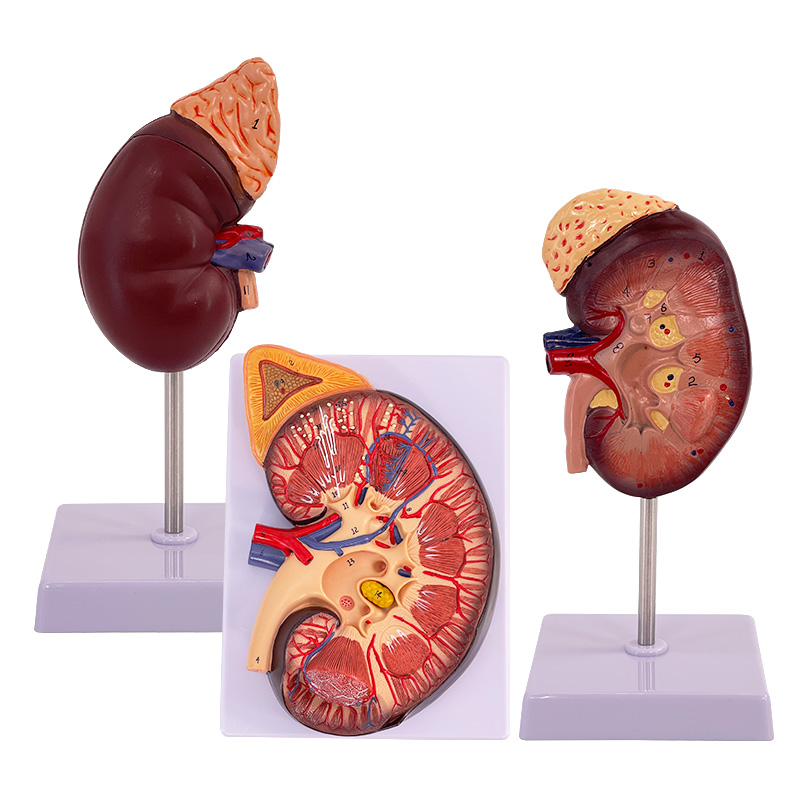 人体肾脏模型肾解剖附肾上腺放大模型病变肾脏人体内脏器官解剖-图3