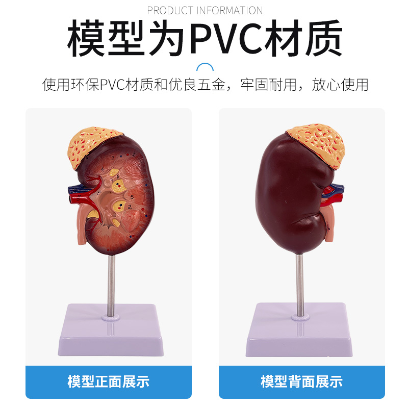 人体肾脏模型肾解剖附肾上腺放大模型病变肾脏人体内脏器官解剖-图0