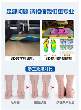 㝝博士2022个性定制矫正鞋垫