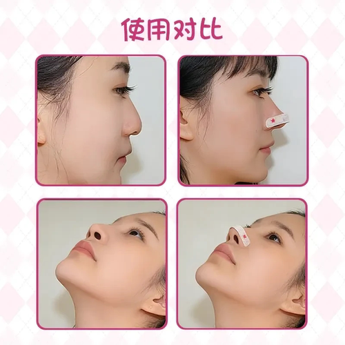 随心翘鼻贴可调节记忆裁剪鼻翼缩小贴矫鼻孔宽大纠正长塑形龙骨贴 - 图1