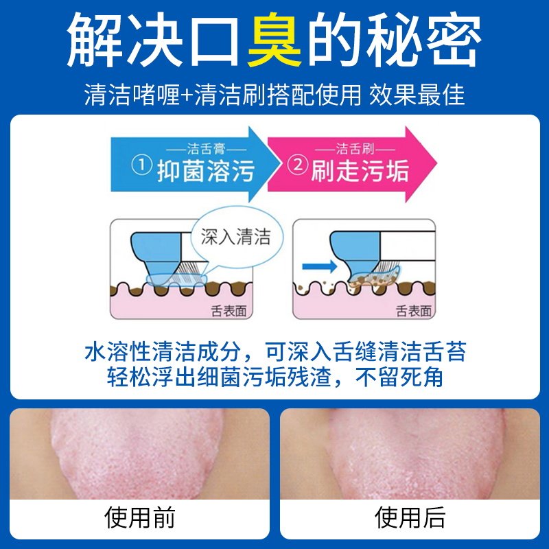 啫喱去异味神器清洁男士舌苔清洁器 朋意牙刷/口腔清洁工具
