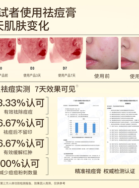 帕达诺青少年控油祛痘护肤品套装洗面奶青春期少女保湿精华水面霜