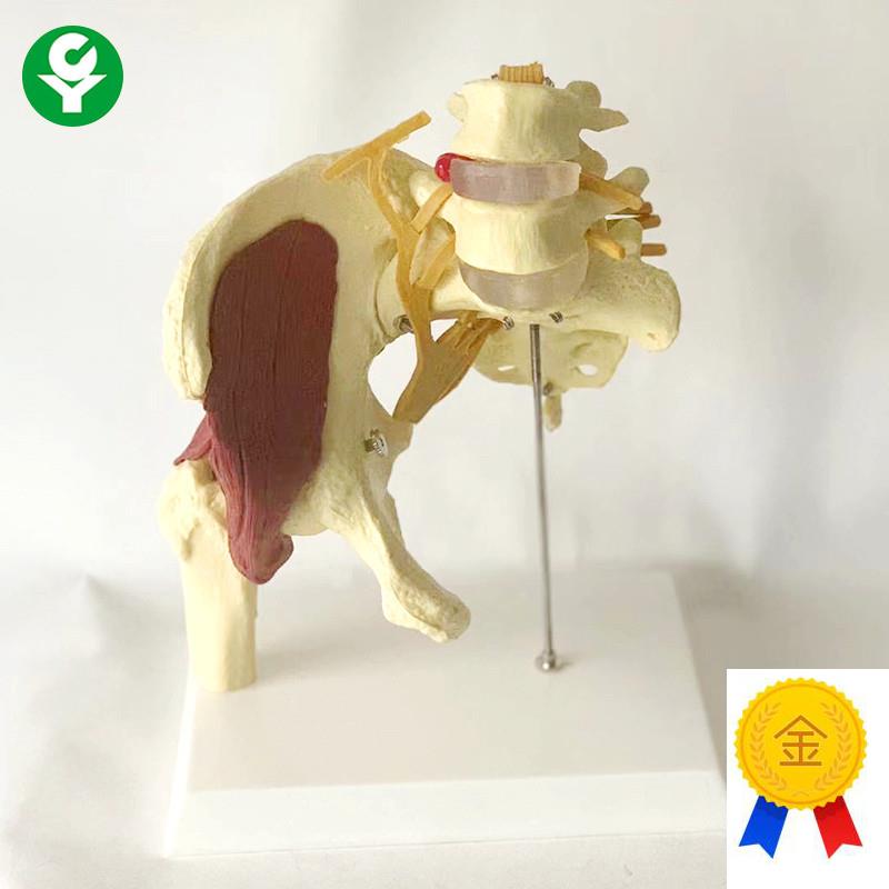 成人腰椎带肌肉模型盆骨腰间盘突A出产妇盆底肌修复演示骶骨神经 - 图0