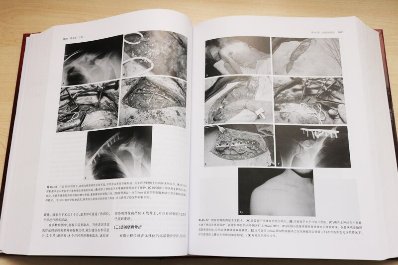创伤骨科学卷骨骼肌肉损伤实用参考书籍从业医师实习医师专业知识 布鲁斯D布朗纳,杰西B朱庇特,艾伦M 天津科技翻译出版公司