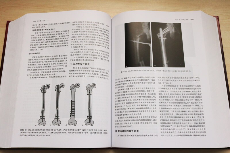 创伤骨科学卷骨骼肌肉损伤实用参考书籍从业医师实习医师专业知识 布鲁斯D布朗纳,杰西B朱庇特,艾伦M 天津科技翻译出版公司