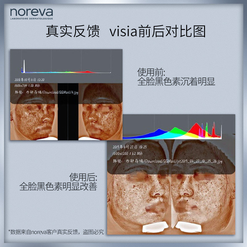 【骆王宇推荐】noreva 30ml抑制黑色素 noreva海外液态精华