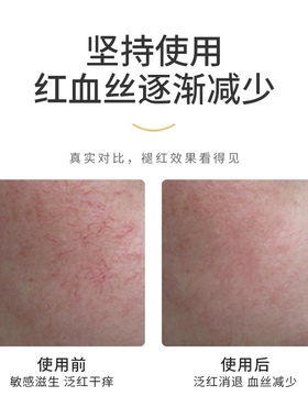 洋甘菊舒缓精华乳过敏角质层激素脸舒缓乳敏感肌退红血丝修护复乳