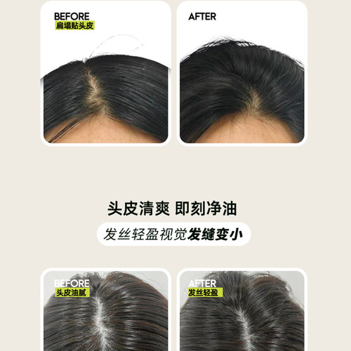 即沐蓬蓬露免洗洗发水保湿舒缓控油温和敏感肌高颅顶护发露福瑞达 - 图1