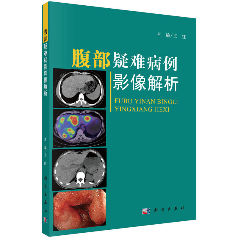 正版包邮腹部疑难病例影像解析王红主编腹腔疾病影像诊断病例分析腹腔疾病罕见典型疾病病例分析腹部疑难病症病例分析教材书-图0