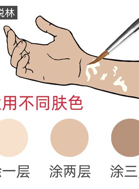 盖脱林白癜风遮瑕液防水持久