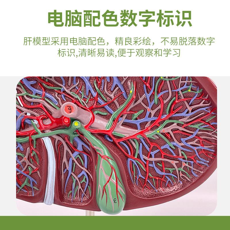 仿真人体肝脏模型肝解剖肝胆胰脾十二指肠病变肝胆U胰肝胆胰胃切 - 图1