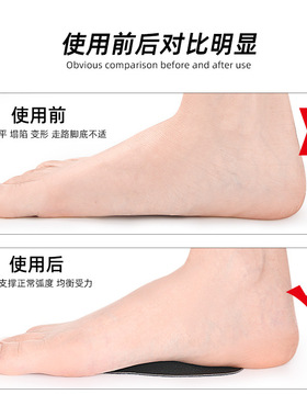 乳胶皮革足弓垫扁平足弓支持脚心垫足内外翻柔软防磨自粘半码鞋垫
