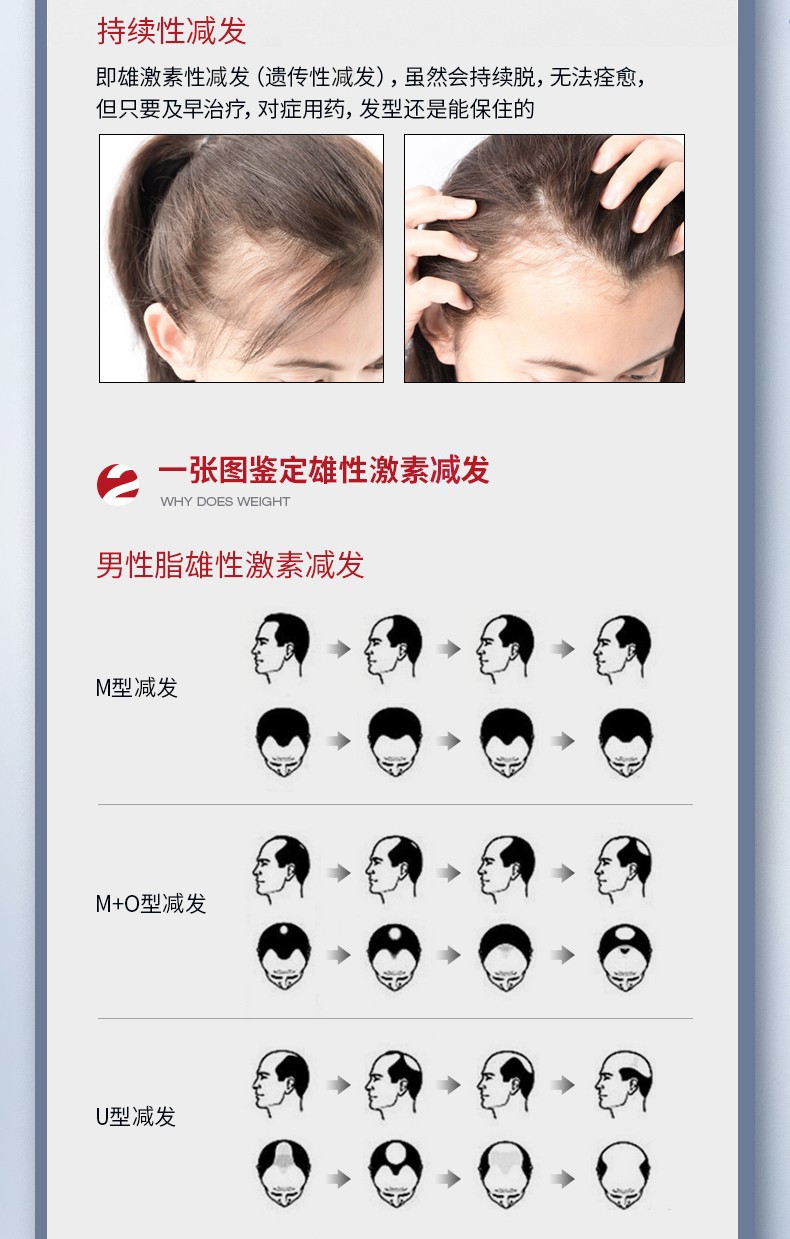 三橡树固发片增发密发神器头发增长精华育发液养发固发剂非MBA-图1