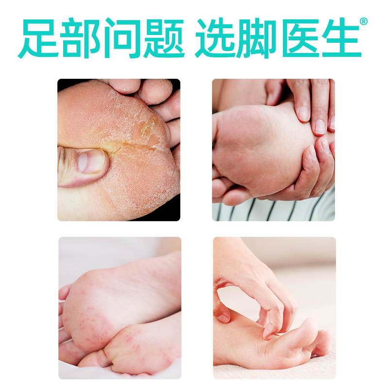 脚医生旗舰店脚臭脚痒喷雾喷剂脱皮泡脚水泡型脚汗脚粉烂臭脚丫