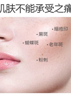 香资美堂祛黄淡印补水润肤