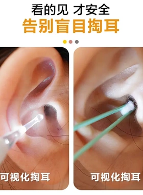 掏耳挖耳勺发光带灯软头宝宝耳屎少儿专用抠扣挖耳朵安全镊子