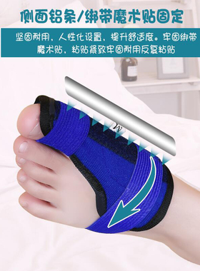拇指外翻矫正器脚趾儿童敬达