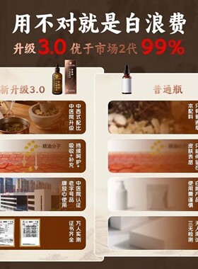 苗九洲三七骨碎补养护油官方正品老中西结合三七骨碎舒缓护理精油