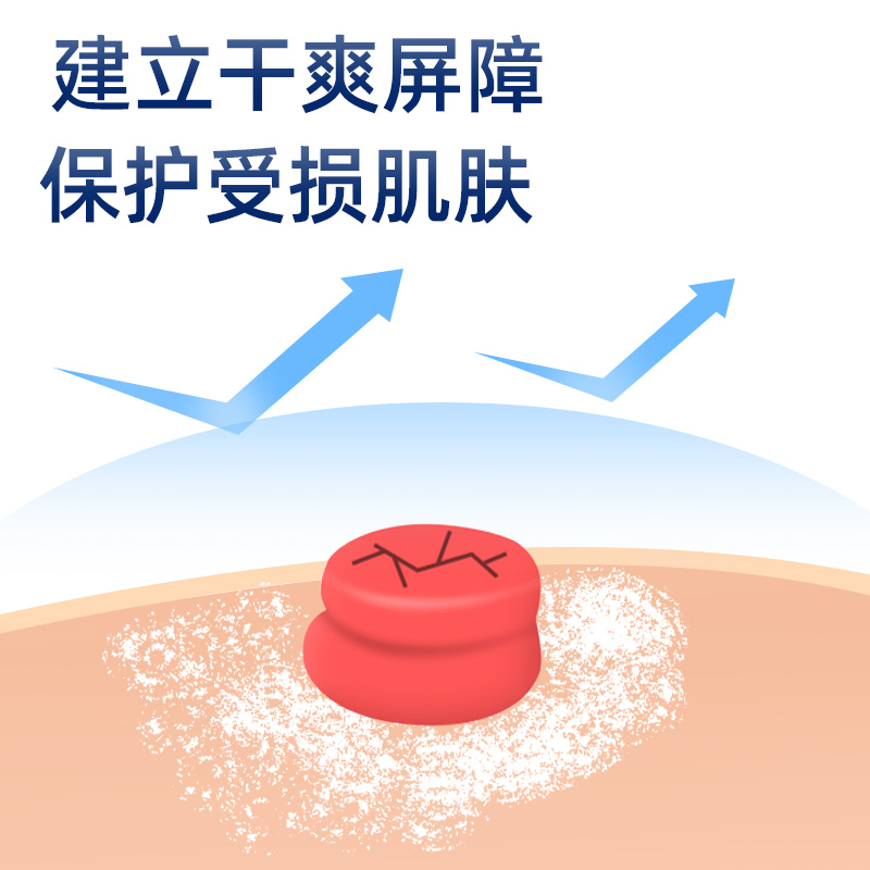 造得乐造口粉造口护肤粉造瘘粉造口护理用品 - 图0