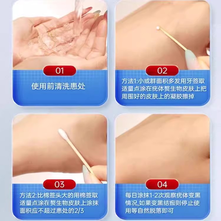 哲也医生祛疣型医用退热凝胶去尤膏医疣瘊用扁平疣官方旗舰店正品