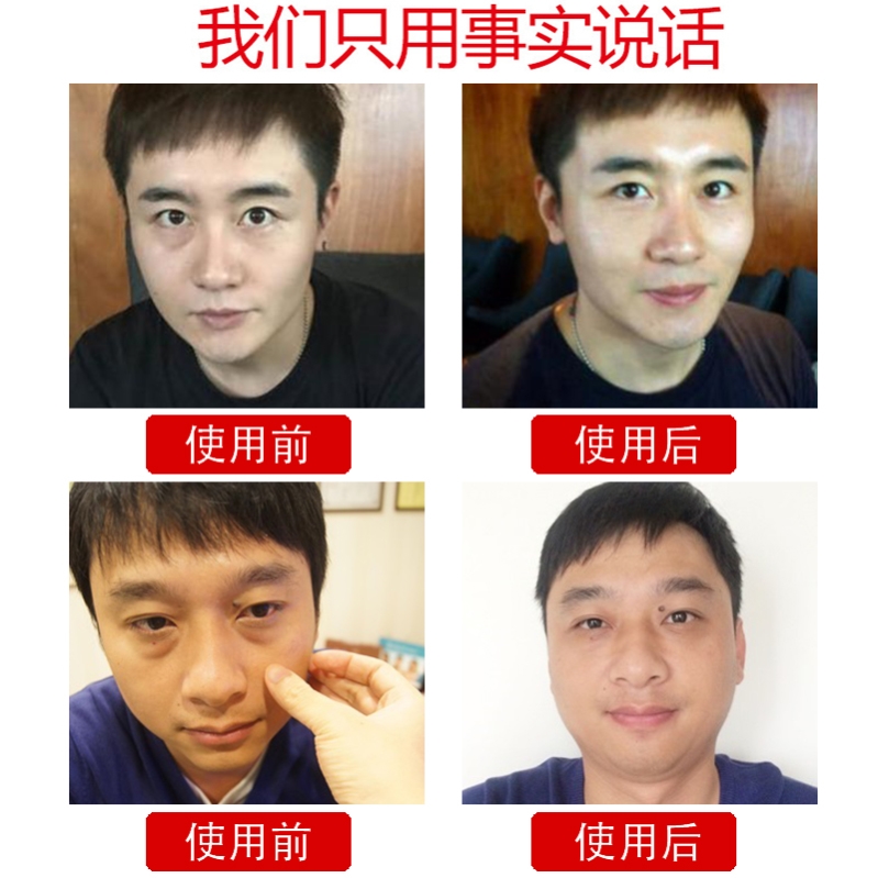 【小红书推荐 】淡化黑眼圈~ 再见眼角纹 收缩眼袋 跟泪沟说拜拜~ - 图0