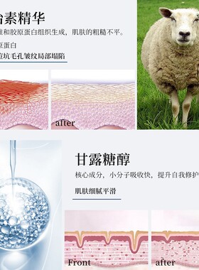EXGYAN 忆香缘 韩国进口原料羊胎素润护冻干粉化妆品套装正品1