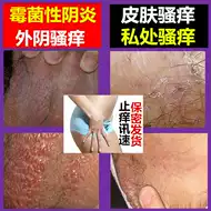 外阴白斑膏 新人首单立减十元 21年7月 淘宝海外