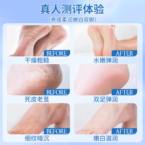 足膜嫩白保湿秋冬补水脚膜去死皮老茧干裂手膜套去角质修复滋养 - 图2