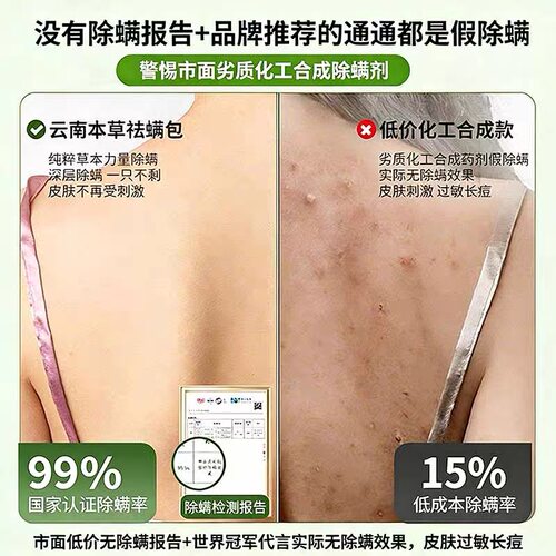 草本除螨包床上用螨虫袪螨光去螨虫神器床上除螨杀菌专用喷雾健康 - 图3