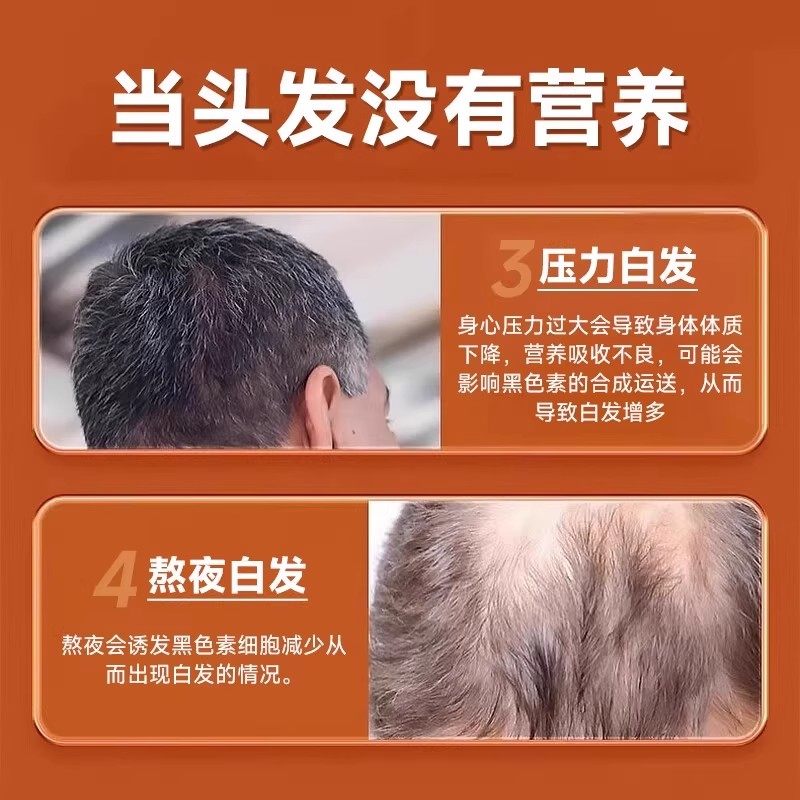 北京同仁堂生物素叶酸铁片维生素b6白发脱发转黑发官方正品旗舰店,淘宝优惠券,粉丝福利购,淘宝优惠卷