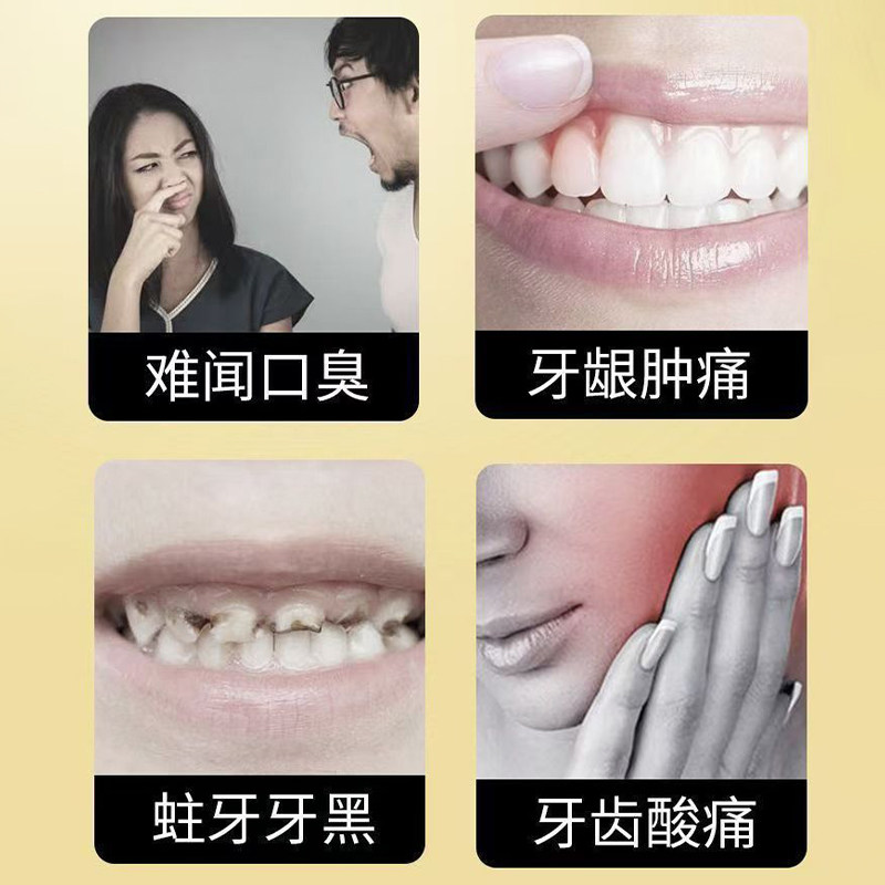 蜂毒牙膏亮白去黄去口气去牙渍焱清清新口气保护牙龈口腔护理牙膏