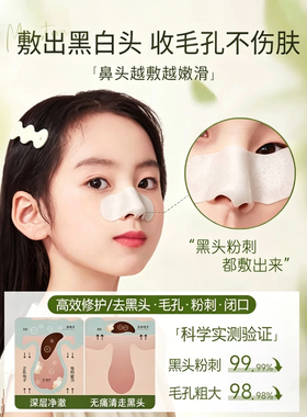 【商超热卖】青少年去黑头鼻贴